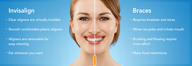 Invisalign-difference