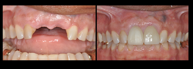 Berkeley restorative dentistry