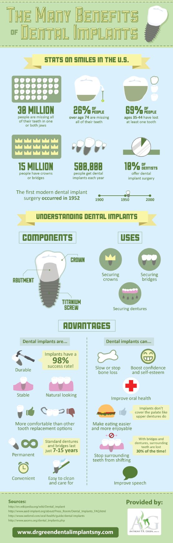 dental implants Berkeley